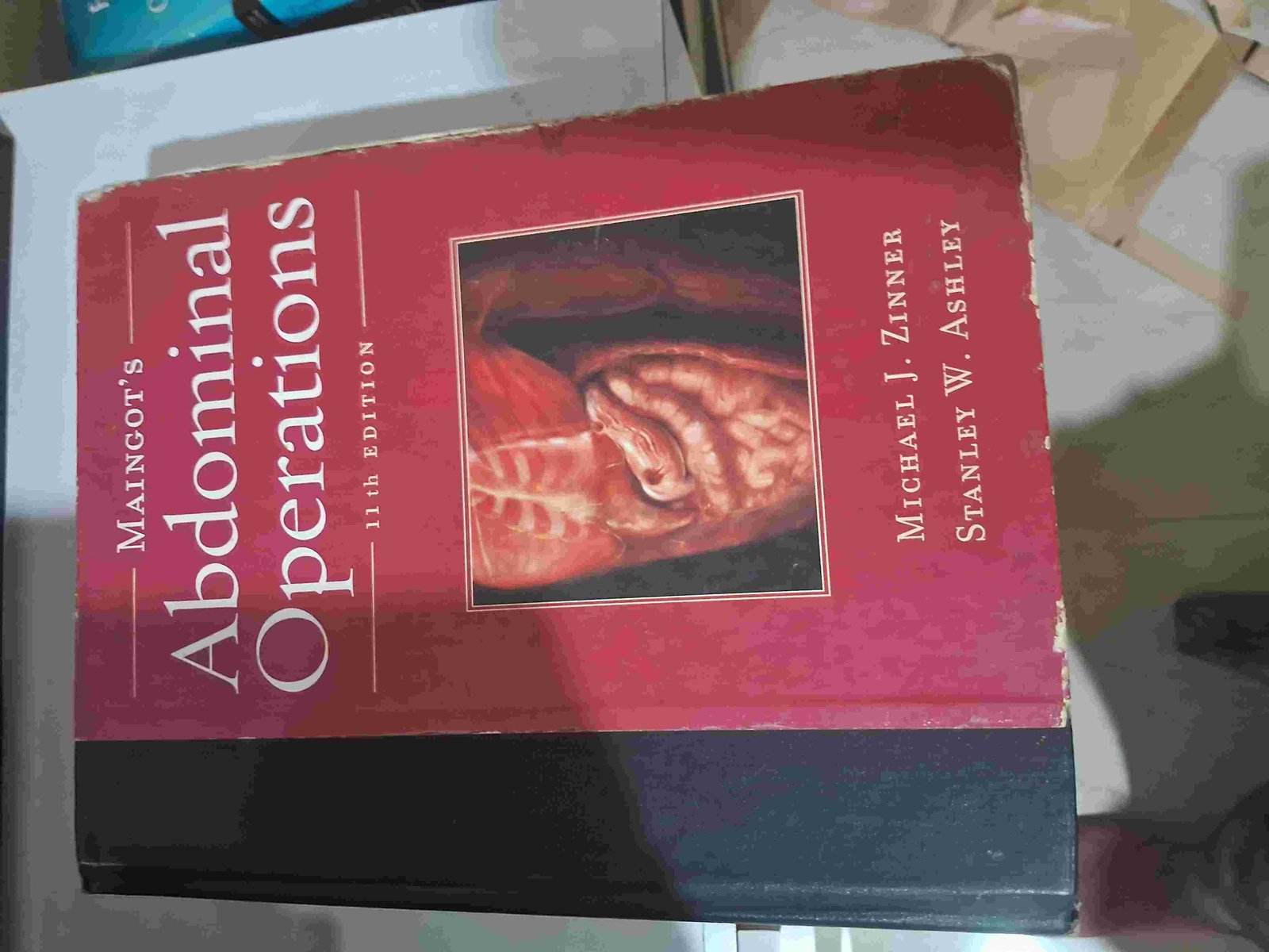 Abdominal Operations - Second Hand - Bookaao